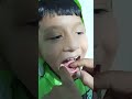 como tirar dente tu criança #viral