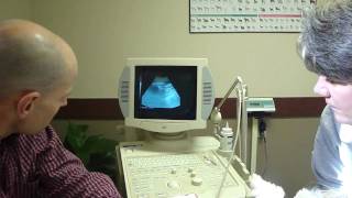 Lolly's ultrasound at 30 days