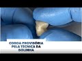 Coroa provisória posterior pela técnica da bolinha