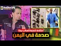  لا سحر ولا حسد هذه القصة الحقيقية والتفسير العلمي لإستخراج ١١٧ مسمار من معدة الشاب اليمني حسين  