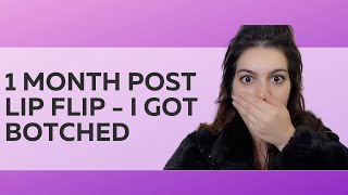 Botox Lip Flip Gone Wrong? 1 Month Results + Regrets (Before & After) Gone Wrong Botox Upper Lip Flip Before And After