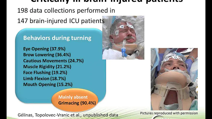 ICU Liberation: Successfully Overcoming Assessment and Treatment Challenges for ICU Pain