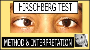 Hirschberg Test Explained |Squint simplified for medical students