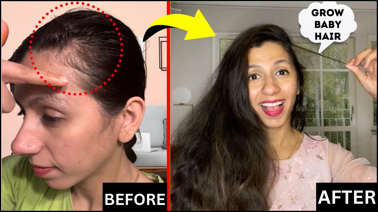 20 best hair growth products for thinning hair | CNN Underscored