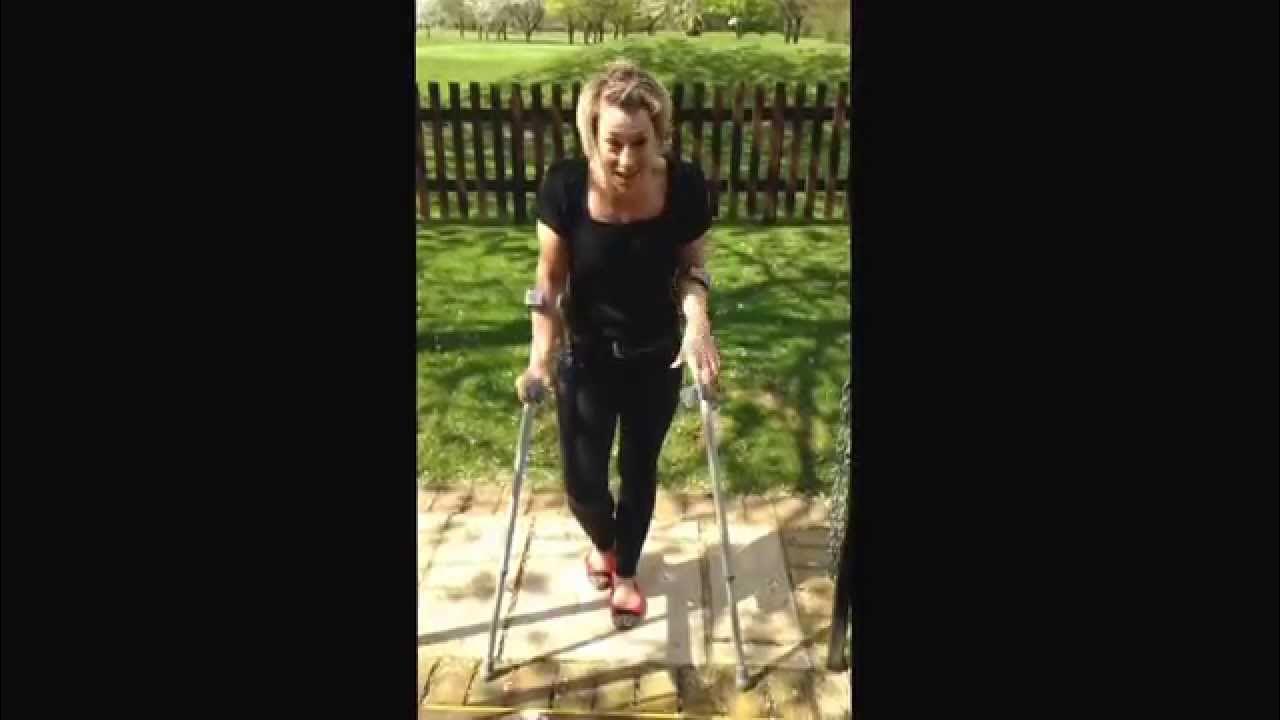 How to ascend stairs, with two crutches, no handrail, partial weight