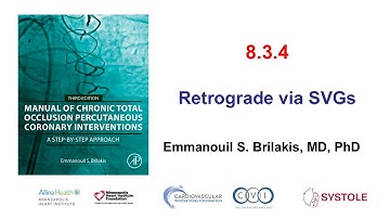 8.3.4: Manual of CTO PCI - Retrograde via SVGs
