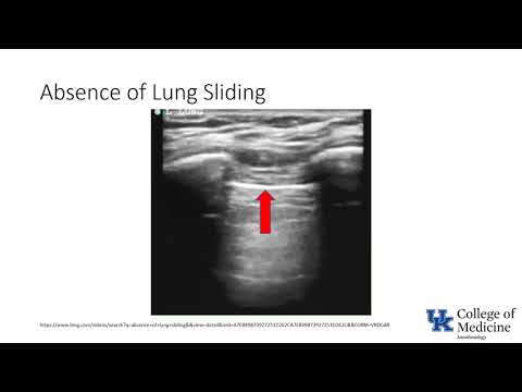 Keyword Review: Respiratory: