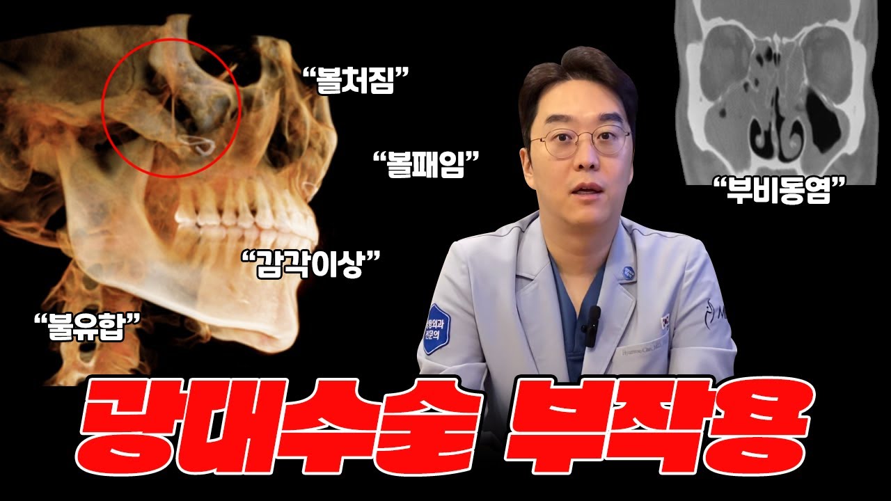 안면윤곽 광대수술 부작용 총정리 [볼처짐/불유합/재발/볼패임/신경손상/부비동염]