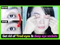 Fast results!! How to get rid of tired eyes, multiple eyelids, deep eye sockets with exercise