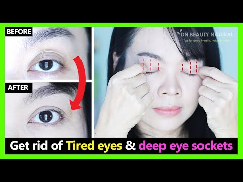 Fast results!! How to get rid of tired eyes, multiple eyelids, deep eye sockets with exercise