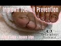 👣Ingrown Toenail Prevention How To Prevent Pedicure at Home👣