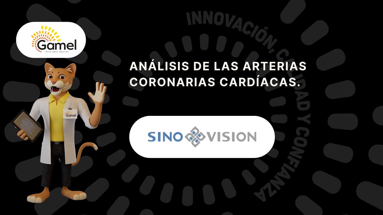 SINOVISION WORKSTATION - CCA - YouTube