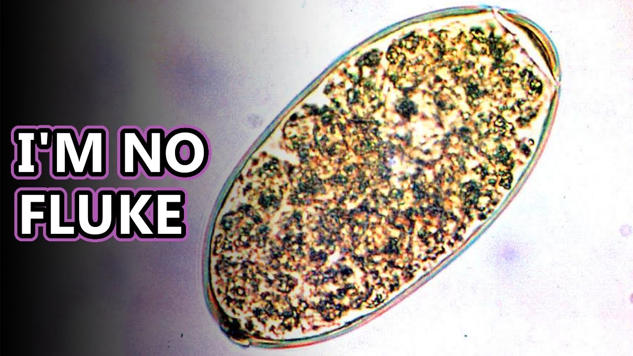 Liver Fluke facts: intestinal parasites