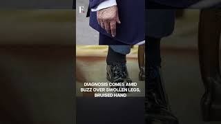 Swollen Legs, Bruised Hand: Trump Has Vein Condition, Says White House | Subscribe to Firstpost|N18G