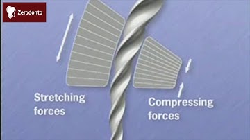 Ni-ti instrument fracture
