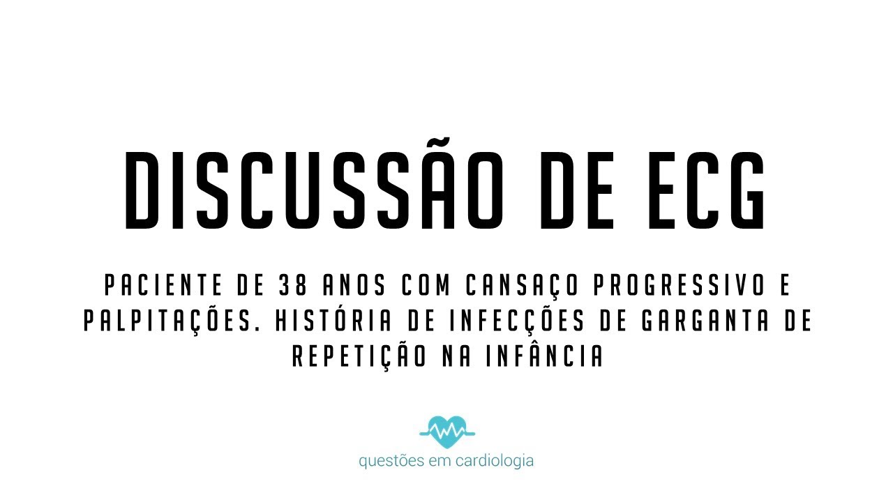ECG Comentado 11 - Jovem com cansaço e palpitações
