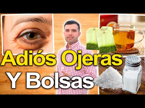 Video: ¿Qué aceite es bueno para las bolsas debajo de los ojos?