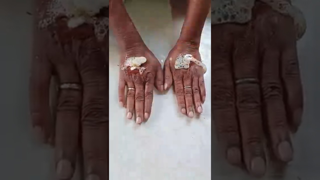 Get Fair Hand||Remove Dirt & Darkness From Hand, Hand Cleaning Tips 
