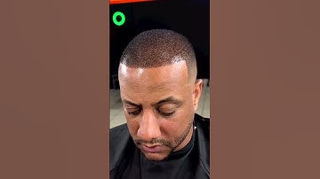 Thumbnail of Balding to full head of hair in minutes! 😏🔥