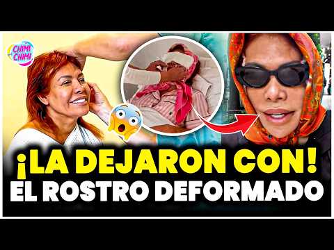 Magaly Medina Reappears With A New Face After Going Through Critical Moments Following Surgery Magaly Medina Reappears With A New Face After Going Through Critical Moments Following Surgery