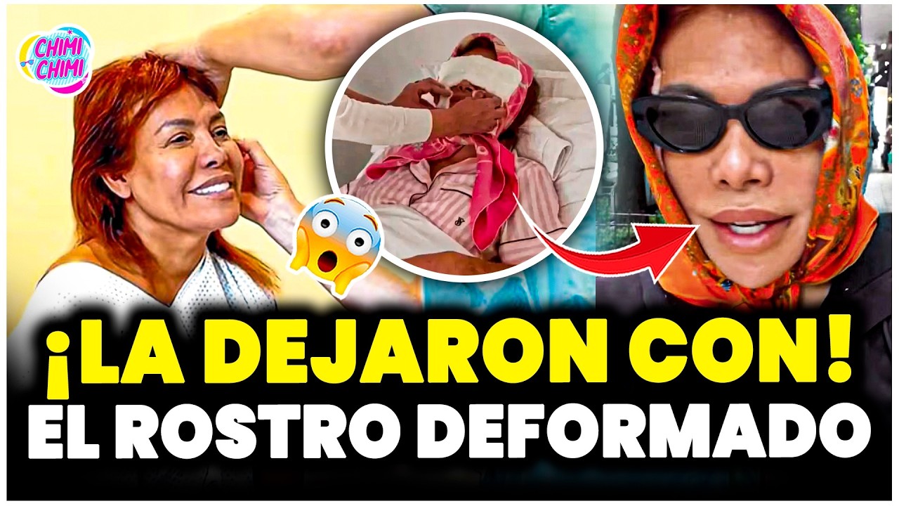 Magaly Medina REAPARECE con nuevo ROSTRO tras pasar momentos críticos tras la cirugía