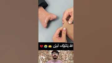 May Allah Heal You Amen Islamic Viral Ytshorts 