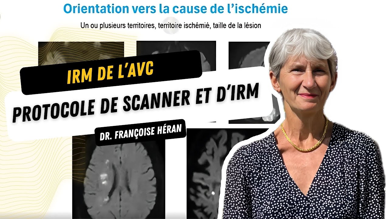 L'Imagerie de l'AVC ischémique - Protocole de scanner et d'IRM