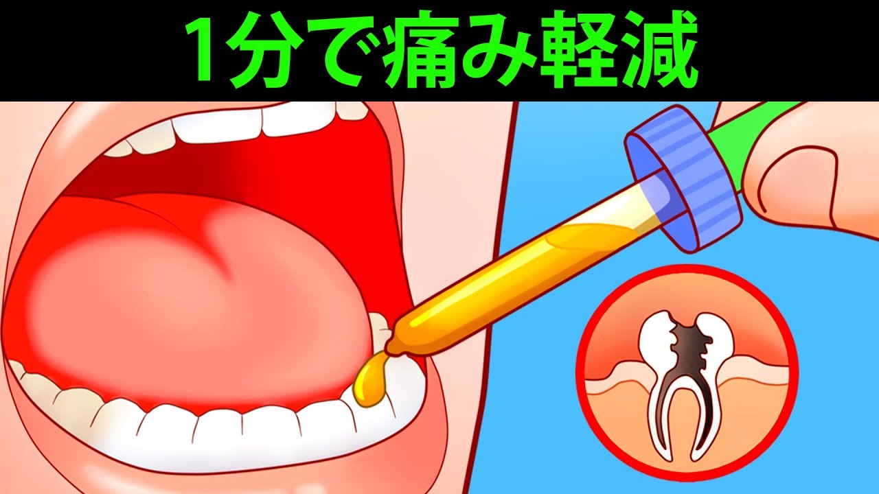 痛く 寝れ ない が 歯 て 歯医者が教える歯が痛くて眠れない時の4つの対処法