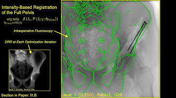 Pose Estimation of Periacetabular Osteotomy Fragments with Intraoperative X-Ray Navigation
