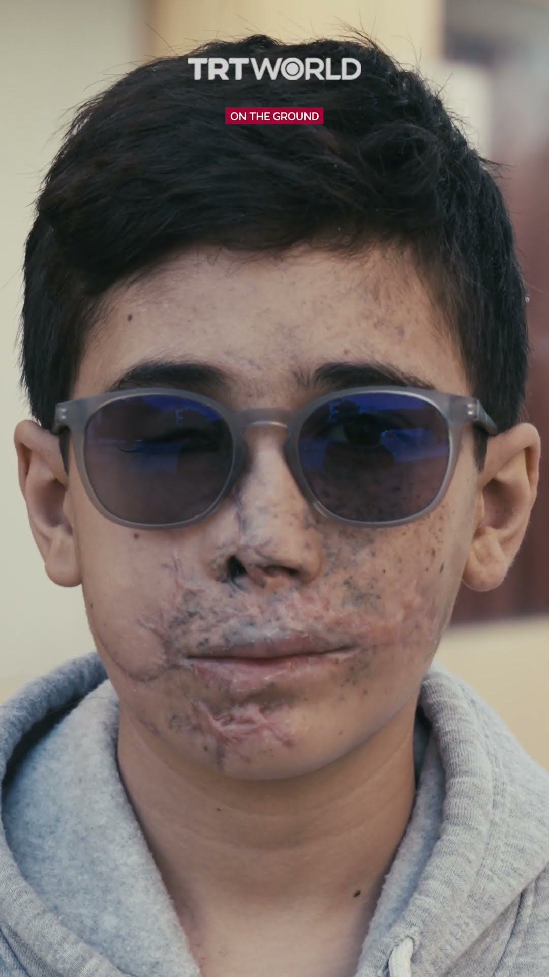 Hussein Haini: survivor of Israel’s pager attacks