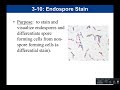 Lab 3-10: Endospore Stain