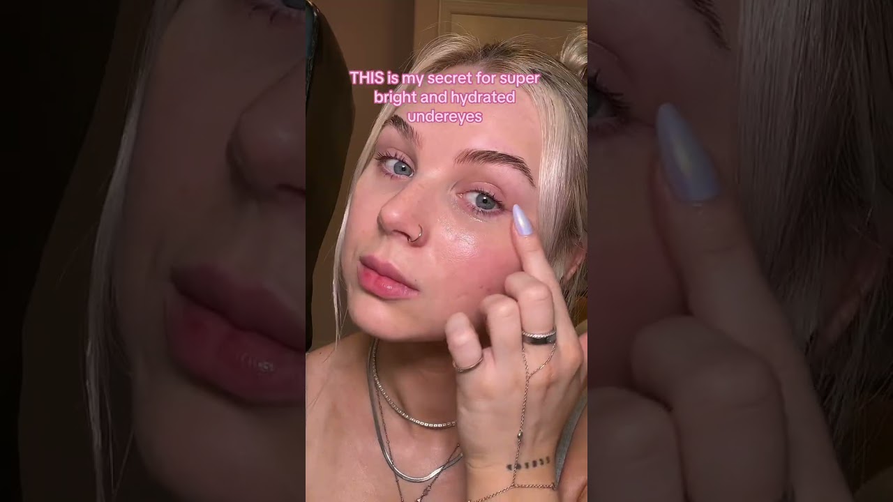 how i healed my dark circles/ under eye bags using castor oil 🫶🏼🫡 