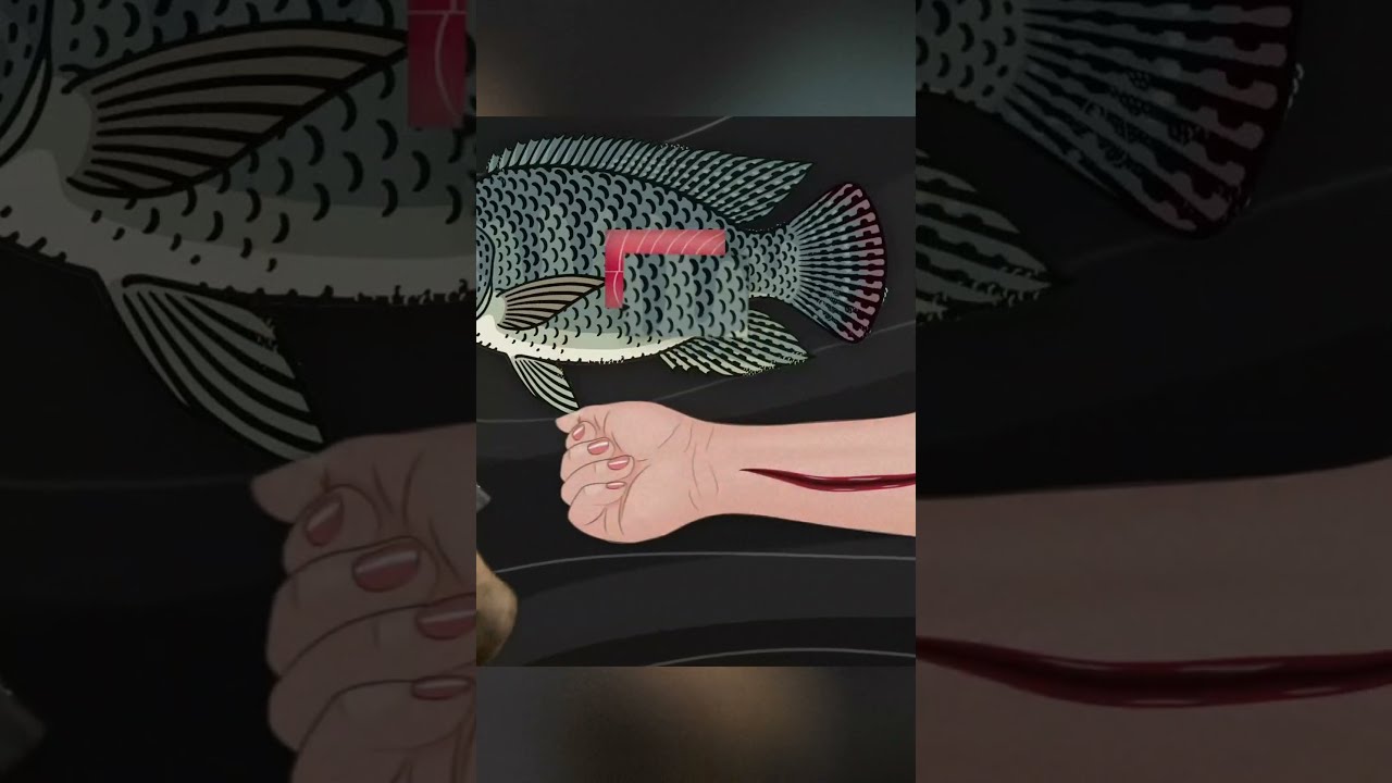 Fish Skin Band Aid For Faster Burn Wound Healing 