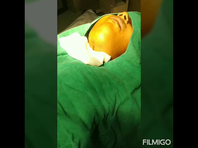 Classic Ludwig angina