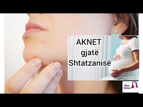 Video: Aknet Gjatë Shtatzënisë. Shkaqet Dhe Metodat E Trajtimit