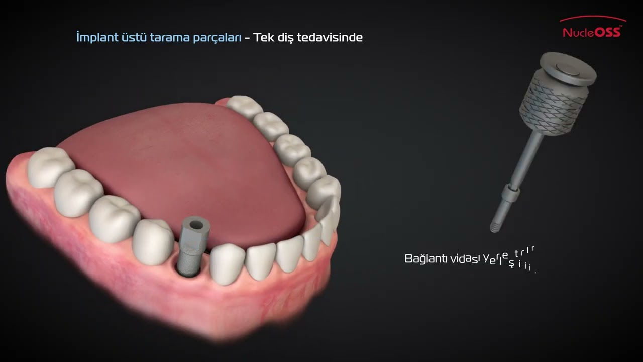 NucleOSS T6 CAD/CAM Tarama Parçaları