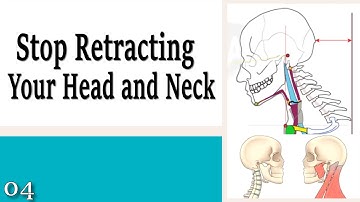04 Stop Retracting Your Head and Neck - Learning to Control Your Neck and Head