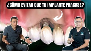 Vas a perder tus implantes dentales si no haces esto by Dr. Federico Baena Q 11,675 views 3 weeks ago 15 minutes
