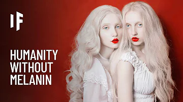 What body part is affected by albinism?
