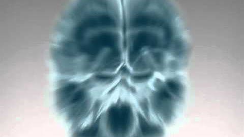 Elekta Oy - Brain Mapping Using Magnetoencephalography (MEG)