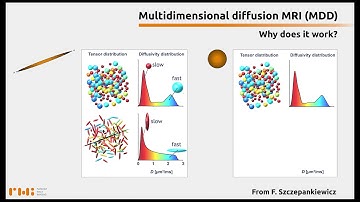 Multidimensional diffusion MRI (MDD)