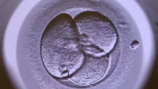 Embryo development (Embryoscope video)