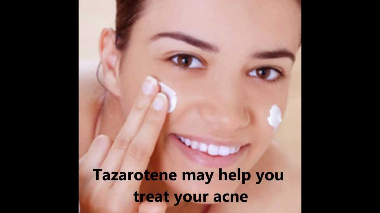 Tazarotene for acne effectiveness and side effects YouTube