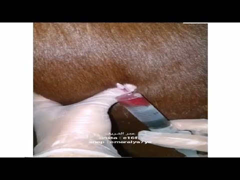 طريقة ضرب الابر وريد وعظل ومعلومات عامة وهامة حول الابر والعلاجات شرح الدكتور احمد العييري