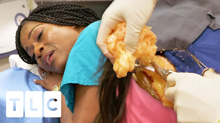 Woman Sings While Dr Lee Removes Her "Talkative" Lipoma | Dr. Pimple Popper Pop Ups - DayDayNews