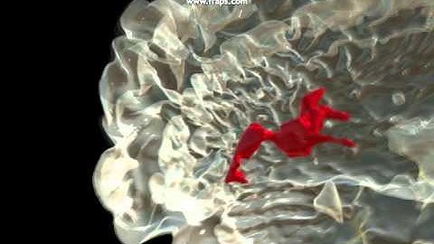 Viewing transparent 3D brain scan with Oculus Rift DK2