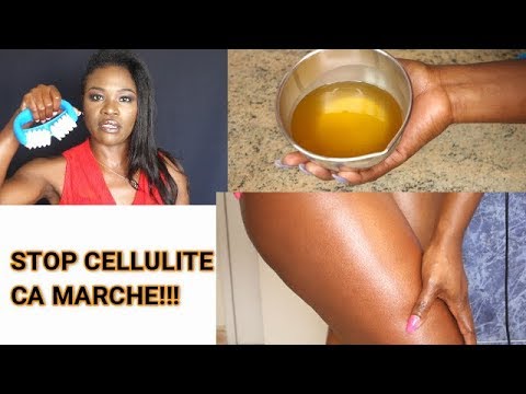 Vidéo: Laysan Utyasheva A Montré Comment Elle Combat La Cellulite En Utilisant Un Rouleau à Pâtisserie Ordinaire