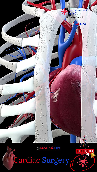 Open Heart 🔪 Cardiac Surgery ╭❤️～ Heart Bypass || 3D Medical Animation