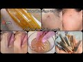 Finger Wax Use Karne Ka Sahi Tarika | Easy Waxing At Home | Smooth Skin Tips 2025 ✨