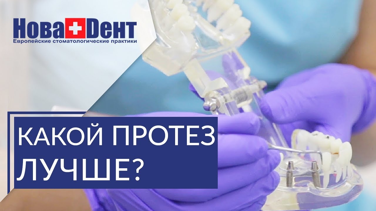 😊 Какие виды протезирования зубов существуют. Виды протезирования зубов ...